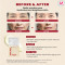 SEOUL 1988 Cream Retinal Liposome 1% + Fermented Rice [50ml] 