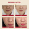 KSECRET SEOUL 1988 Essence : Snail Mucin 97% + Rice 100ml